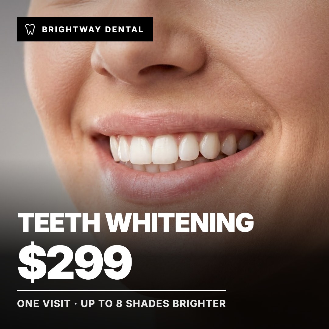 Brightway Dental ad: Teeth Whitening $299